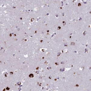Anti-WDPCP antibody produced in rabbit 
