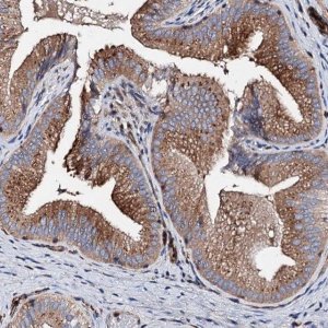 Anti-WDR11 antibody produced in rabbit 