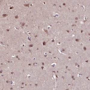 Anti-WDR17 antibody produced in rabbit 