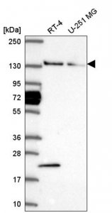 Anti-WDR19 antibody produced in rabbit 