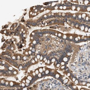 Anti-WDR31 antibody produced in rabbit 