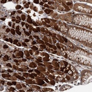 Anti-WDR34 antibody produced in rabbit 