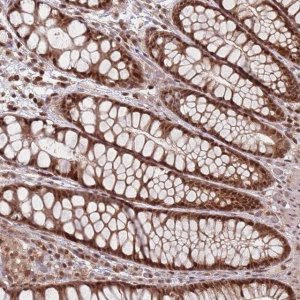 Anti-WDR55 antibody produced in rabbit 
