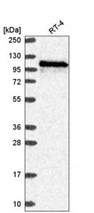 Anti-WDR59 antibody produced in rabbit HPA048218-100UL