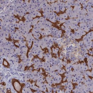 Anti-WDR6 antibody produced in rabbit 