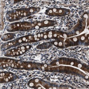 Anti-WDR60 antibody produced in rabbit 