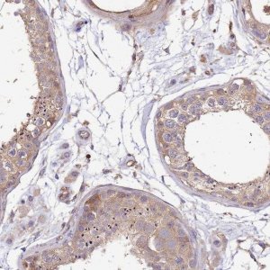 Anti-WDR64 antibody produced in rabbit 