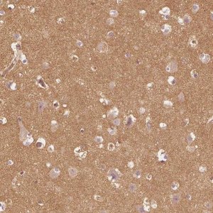 Anti-WDR7 antibody produced in rabbit 