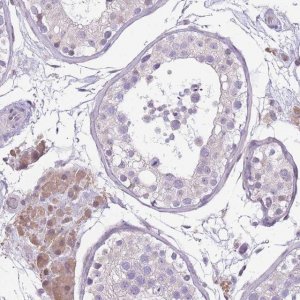 Anti-WDR70 antibody produced in rabbit 