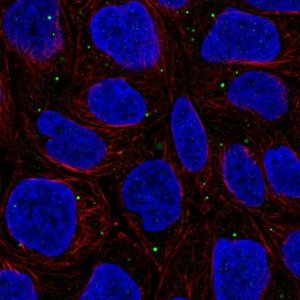 Anti-WDR72 antibody produced in rabbit 