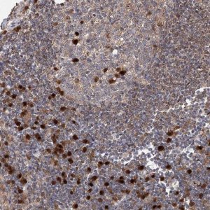Anti-WDR75 antibody produced in rabbit 