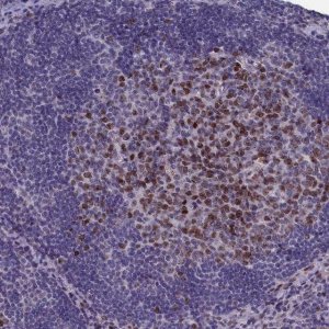 Anti-WDR76 antibody produced in rabbit 