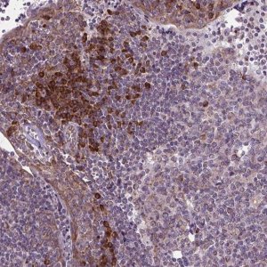 Anti-WDR83OS antibody produced in rabbit HPA065685-100UL