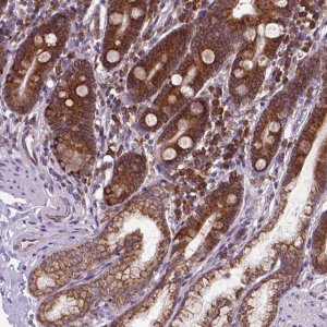 Anti-WDR83OS antibody produced in rabbit HPA065685-100UL
