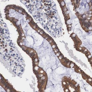 Anti-WDR89 antibody produced in rabbit HPA000813-100UL