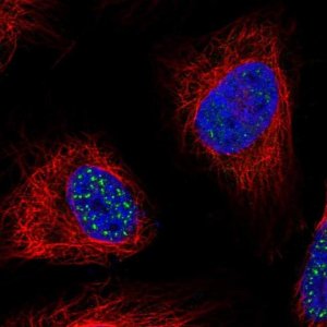 Anti-WDR90 antibody produced in rabbit 