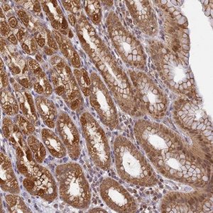 Anti-WDR92 antibody produced in rabbit 