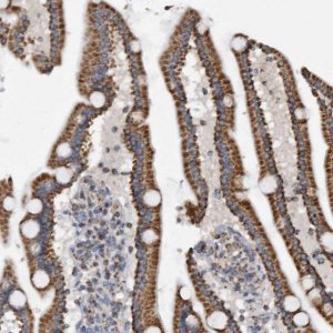Anti-WFDC1 antibody produced in rabbit 