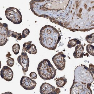 Anti-WHAMM antibody produced in rabbit 
