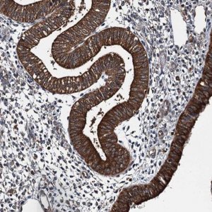 Anti-WHAMM antibody produced in rabbit 