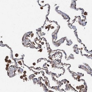 Anti-WIF1 antibody produced in rabbit 