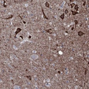 Anti-WIPF3 antibody produced in rabbit 
