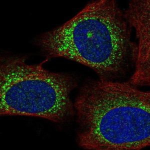 Anti-WISP3 antibody produced in rabbit 