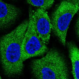 Anti-WNK1 antibody produced in rabbit 