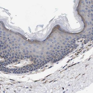 Anti-WNT10A antibody produced in rabbit 