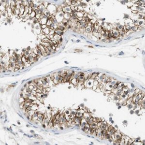 Anti-WNT7A antibody produced in rabbit 