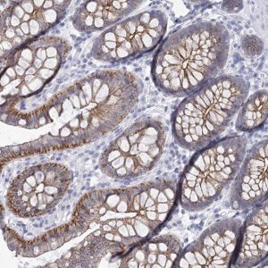 Anti-WNT8B antibody produced in rabbit 