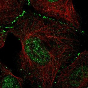 Anti-WRAP73 antibody produced in rabbit 