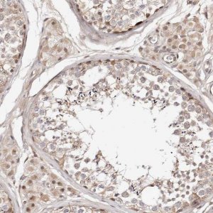 Anti-WRN antibody produced in rabbit 
