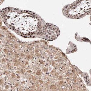 Anti-WRN antibody produced in rabbit 