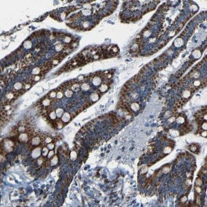 Anti-WSCD2 antibody produced in rabbit HPA013346-100UL
