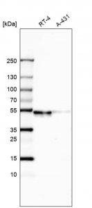 Anti-WSCD2 antibody produced in rabbit HPA013346-100UL