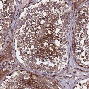 Anti-WWC2 antibody produced in rabbit 