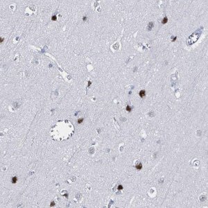 Anti-XAGE3 antibody produced in rabbit 