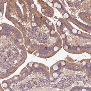 Anti-XIAP antibody produced in rabbit 