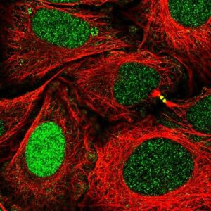 Anti-XPA antibody produced in rabbit 