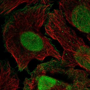 Anti-XPC antibody produced in rabbit 