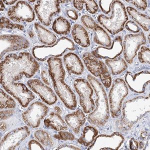 Anti-XPO6 antibody produced in rabbit 