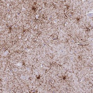 Anti-XPO7 antibody produced in rabbit 
