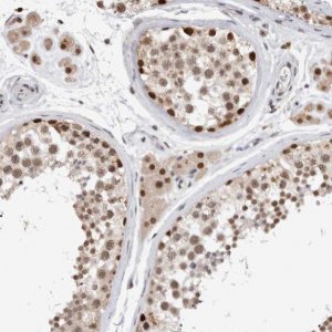 Anti-XRCC5 antibody produced in rabbit 