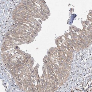 Anti-XRN1 antibody produced in rabbit 
