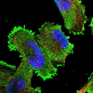 Anti-XRN1 antibody produced in rabbit 