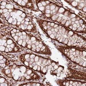 Anti-XRN2 antibody produced in rabbit 