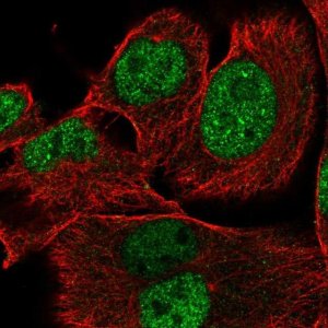 Anti-XRRA1 antibody produced in rabbit 
