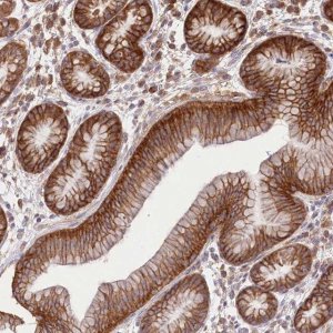 Anti-XYLB antibody produced in rabbit 