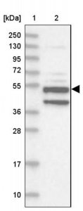 Anti-XYLB antibody produced in rabbit 